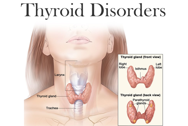 Thyroid