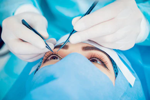 Glaucoma