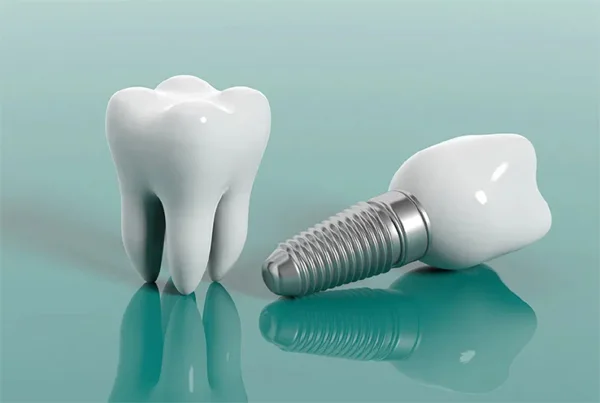 Dental Implants