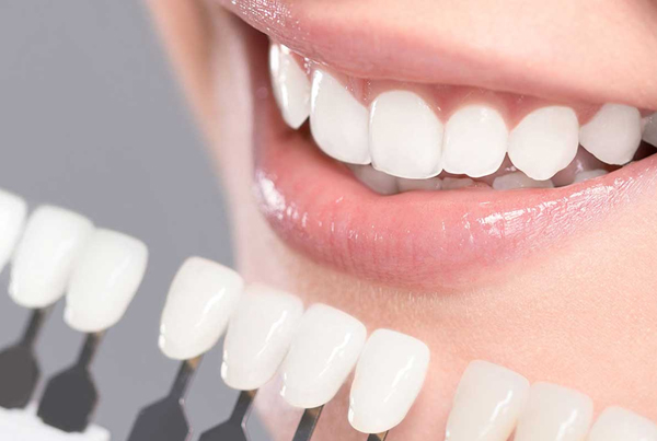 Teeth Whitening